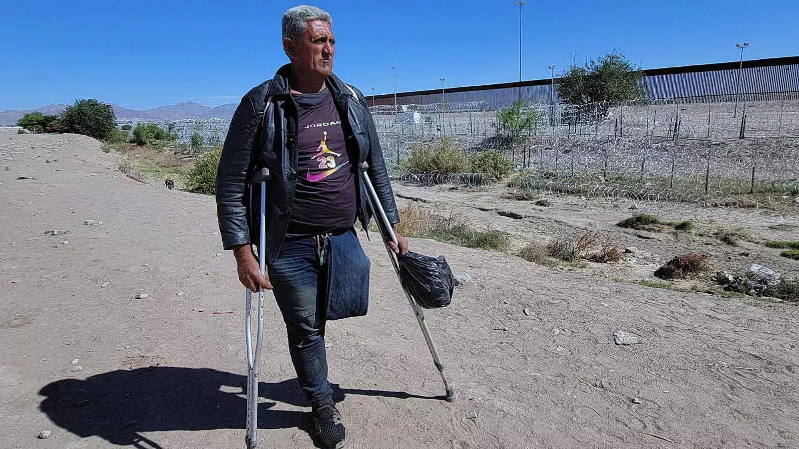 Venezolano llega con una sola pierna a la frontera de México en busca de una prótesis en EEUU