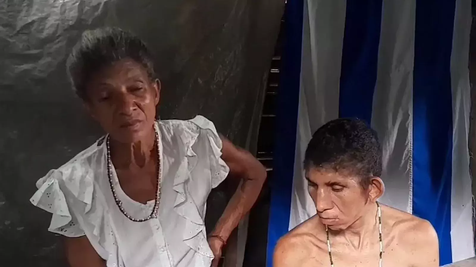 Madre cubana con un hijo discapacitado vive en extrema pobreza