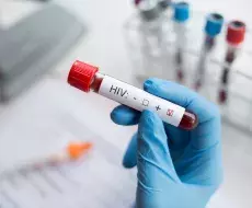 Nuevos avances en la investigación par una vacuna eficaz frente al VIH