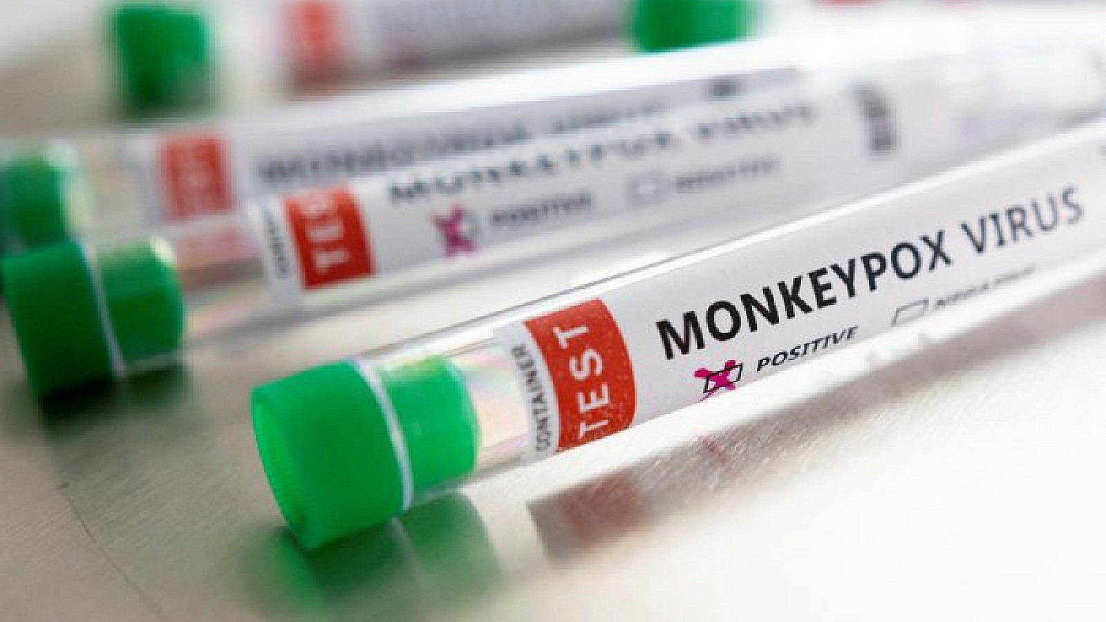 La organización consideró que el actual brote de viruela del mono fuera de África difícilmente podría provocar una pandemia | Reuters