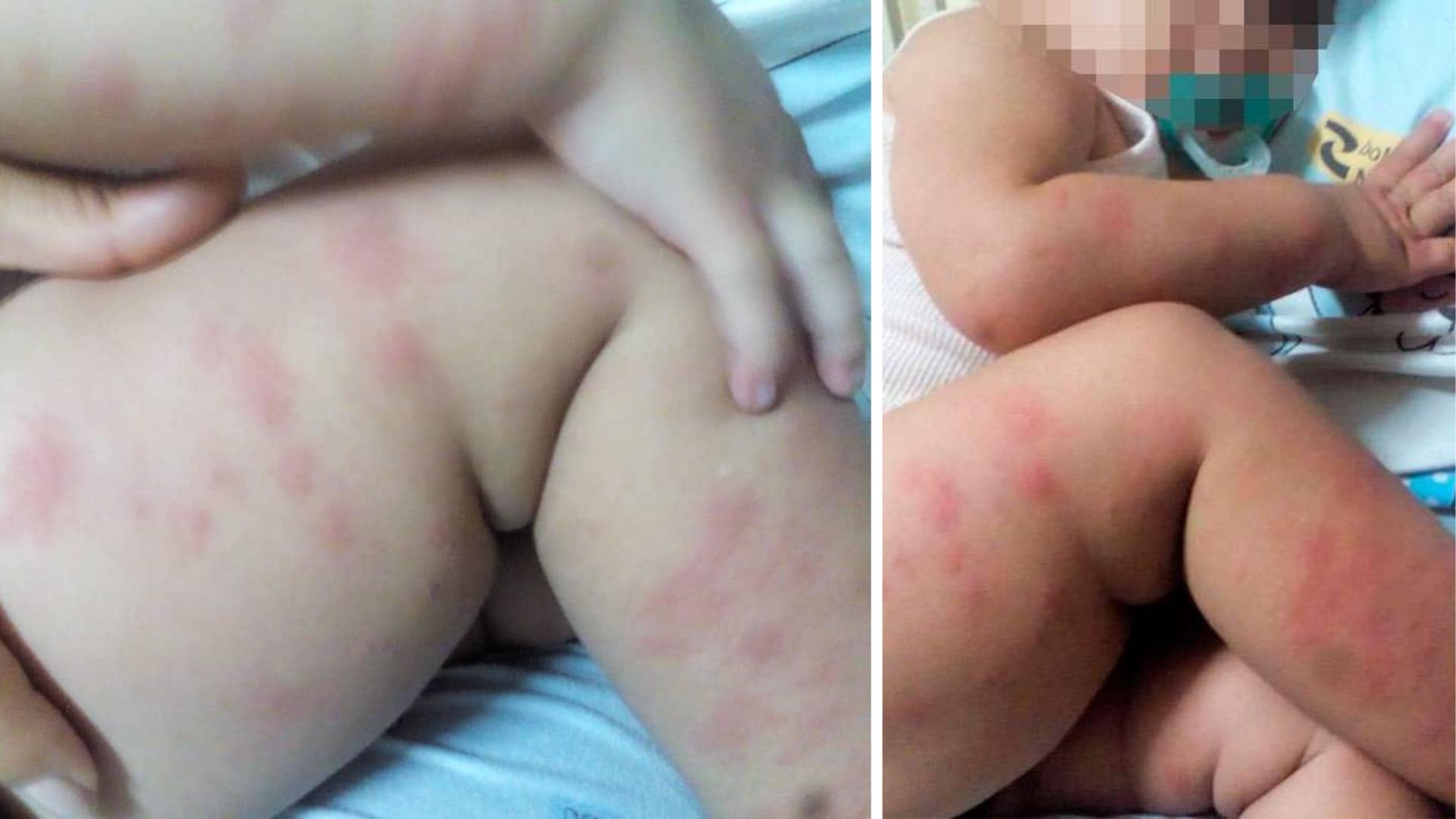 Padre denuncia mosquitos en círculo infantil
