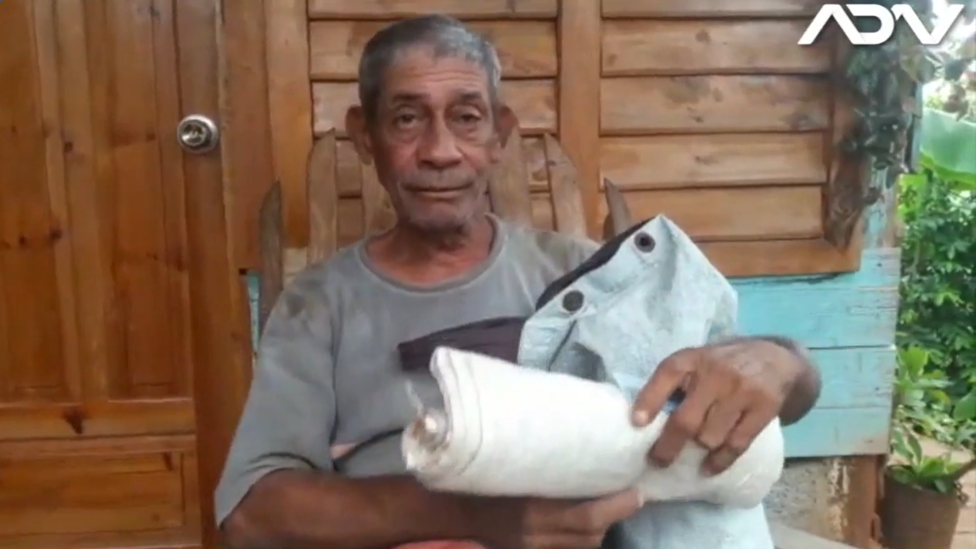 Cubano desamparado: “Vivo en la calle y duermo en el parquecito”