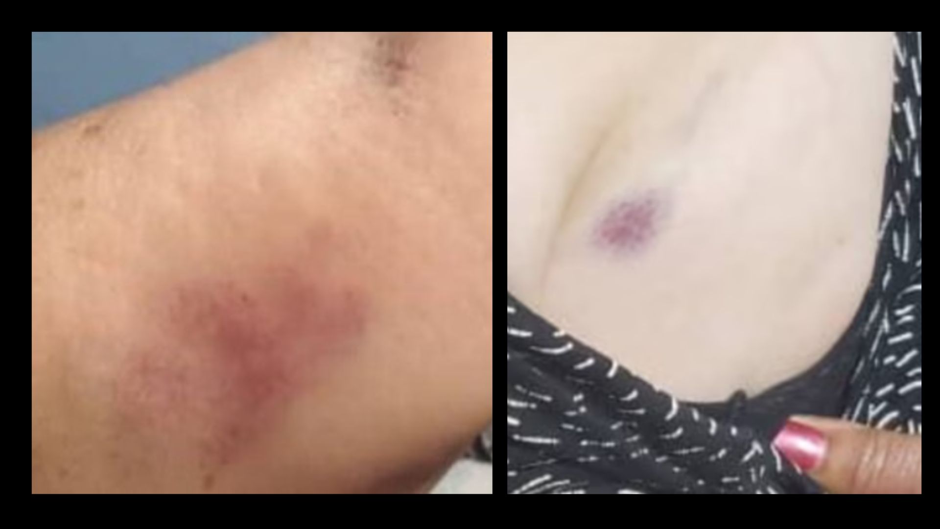 Golpes a Annia Zamora