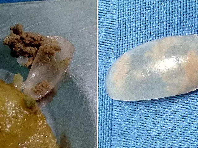 Foto: Twitter/@El_Anestesista_