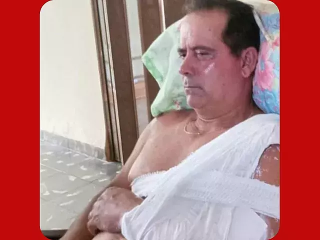 Alberto Corzo tras la agresión. Foto: ICLEP