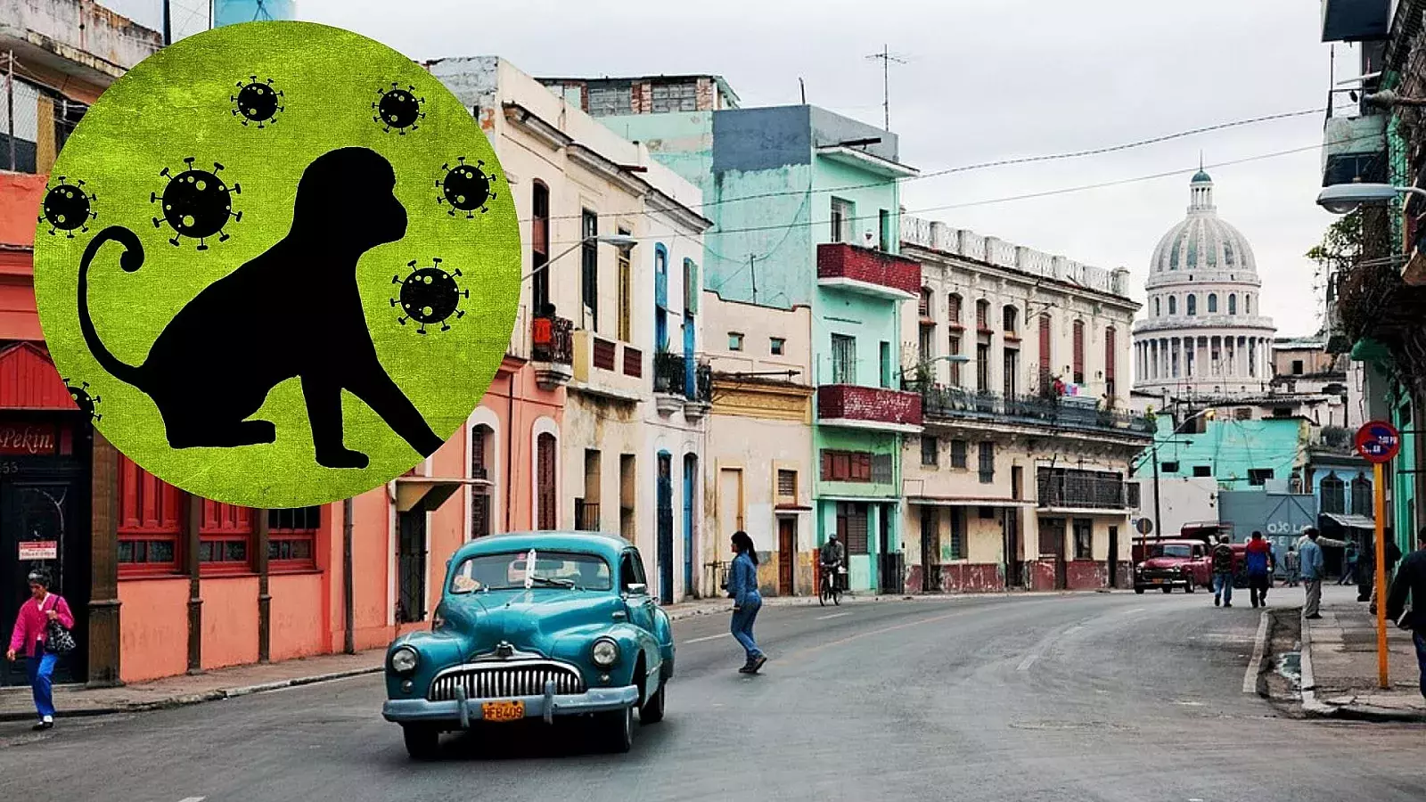 Viruela del mono en Cuba