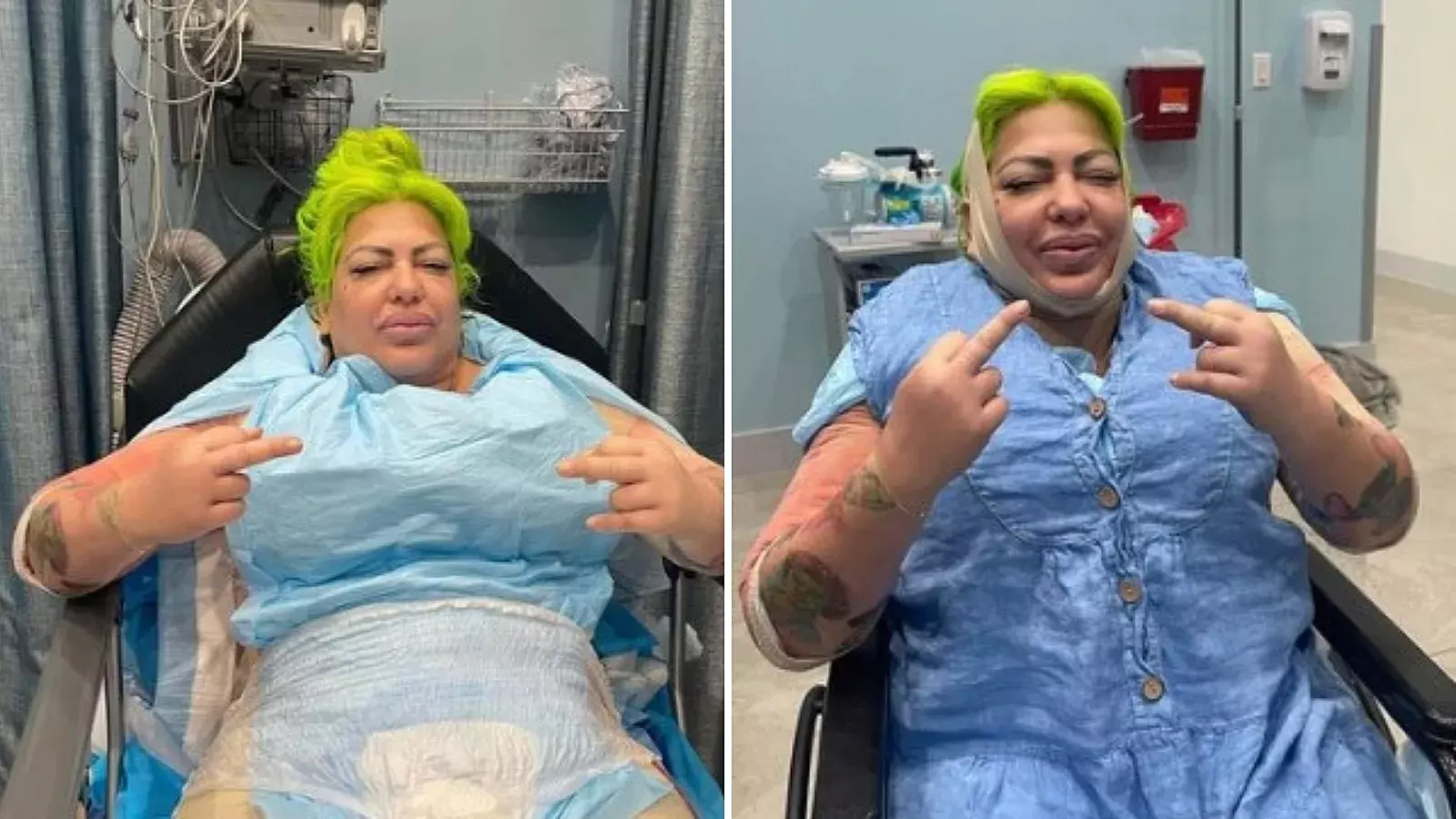 La Diosa de Cuba sale de su primera cirugía estética