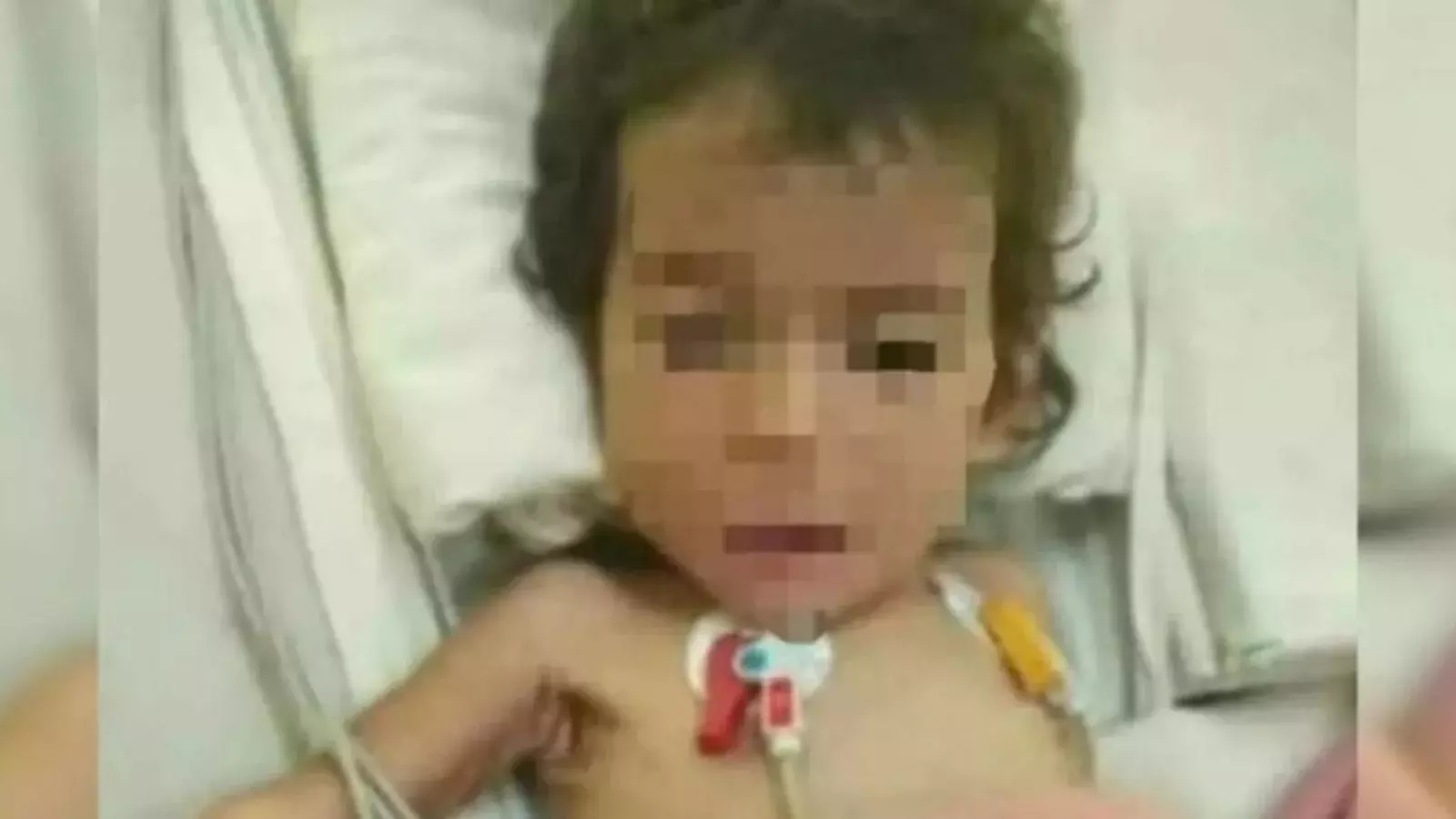 Bebé de 11 meses abandonada y desnutrida en hospital de Santa Clara