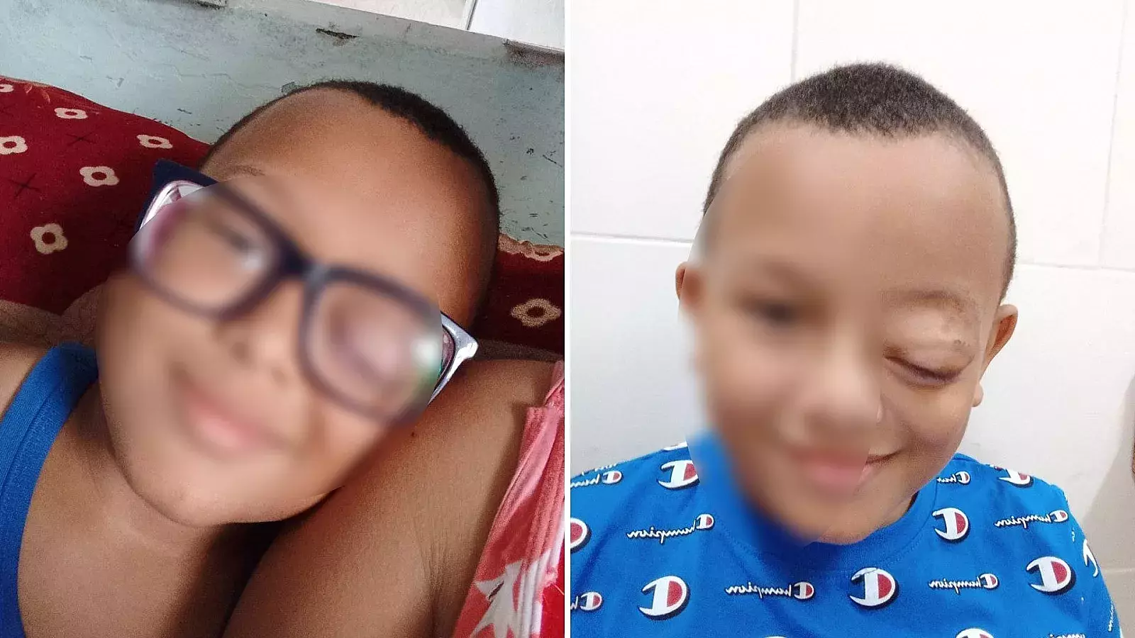 Niño con tumor en el ojo imposibilitado de operarse en Cuba
