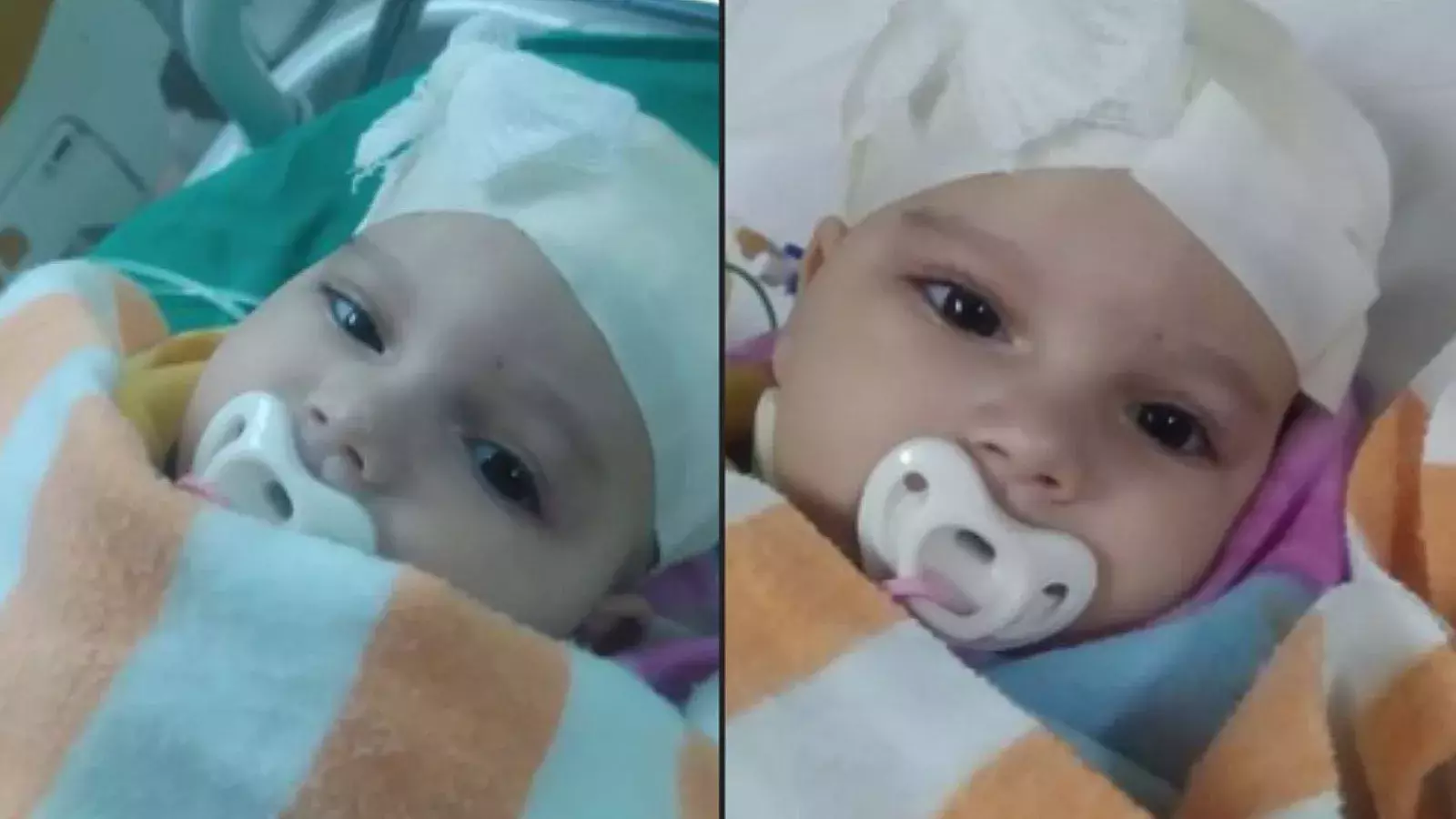Bebé operada de tumor en Cuba tras más de un mes de espera