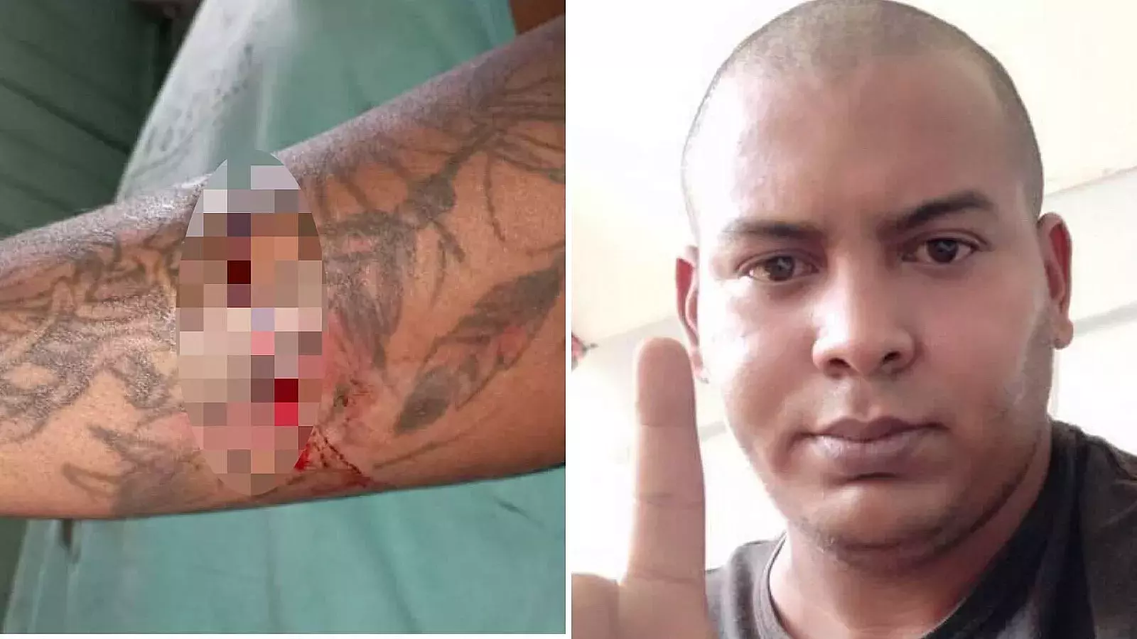 Ataque de arma blanca contra activista Alejandro Garlobo