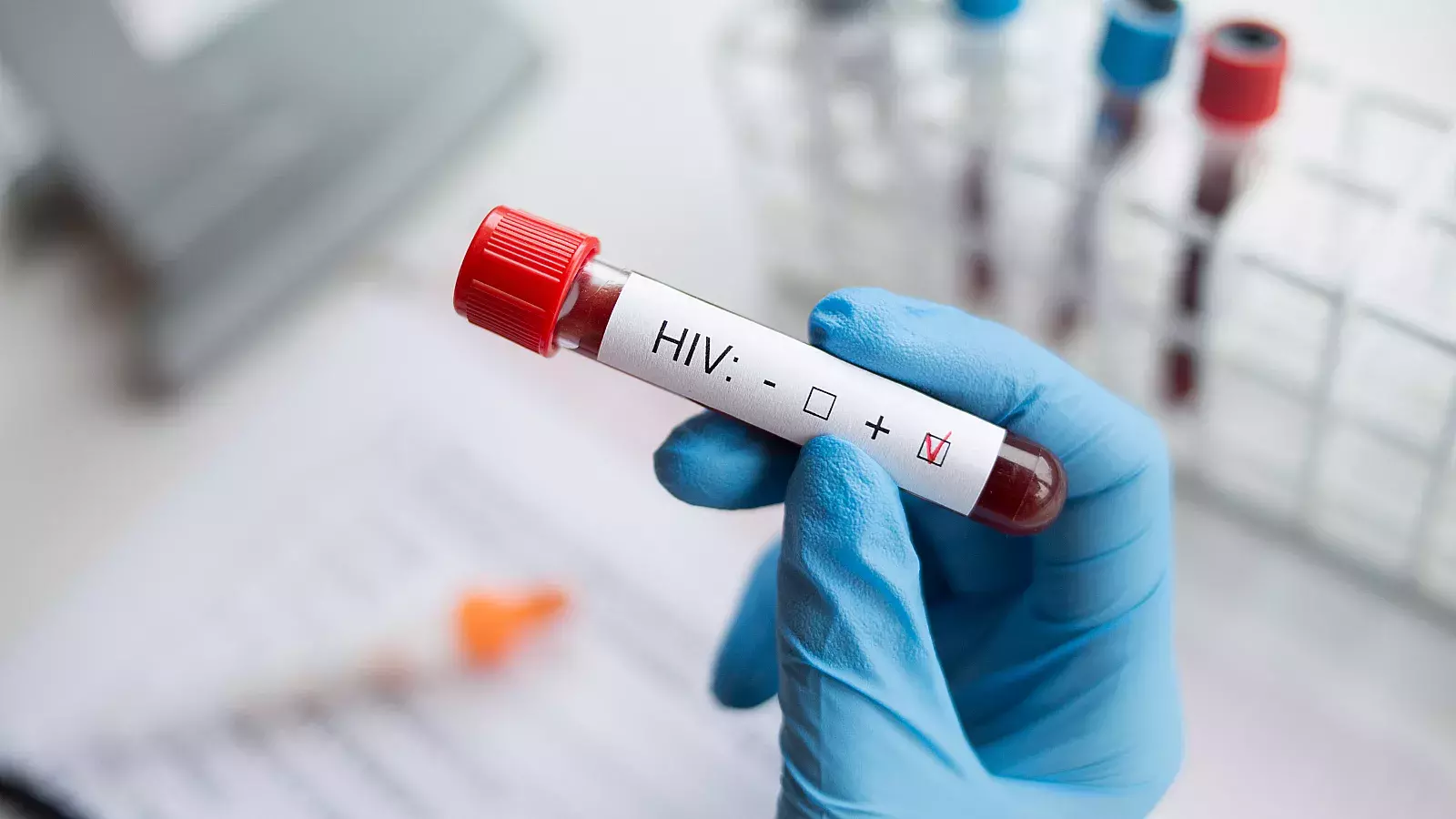 Nuevos avances en la investigación par una vacuna eficaz frente al VIH