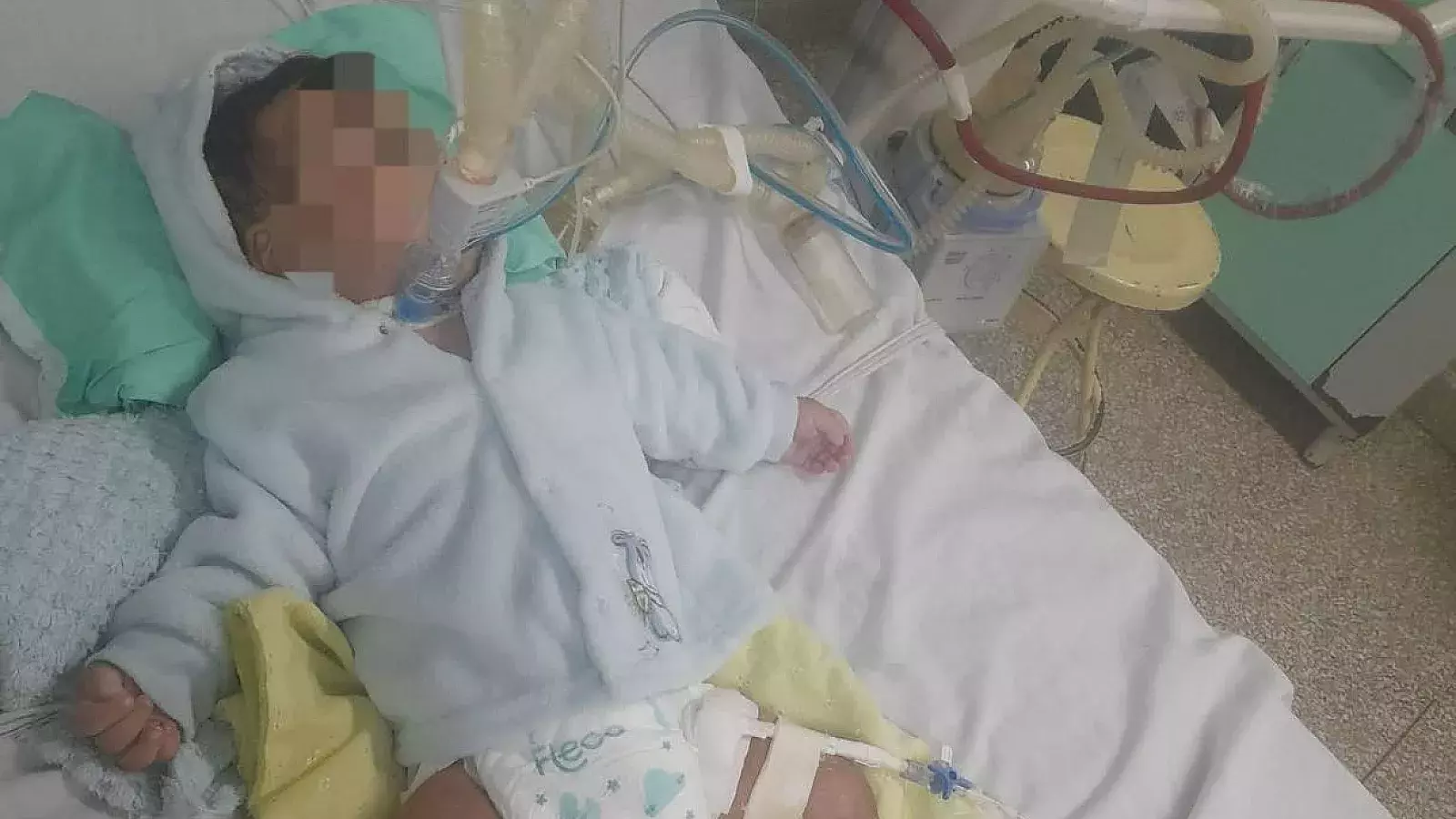 Bebé cubano necesita cirugía urgente