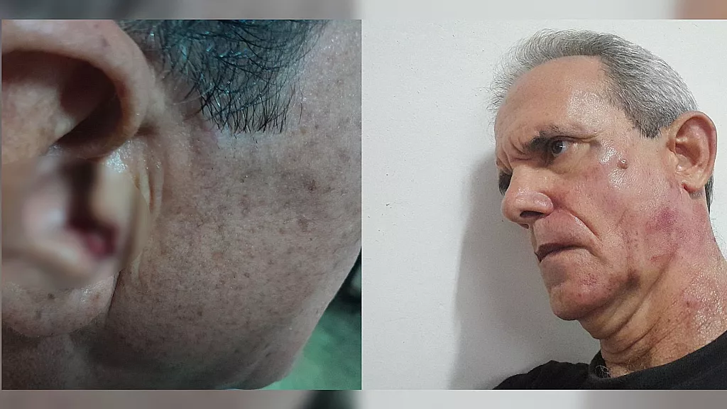 Escritor cubano Jorge Fernández Era, golpeado por un teniente de la policía política en julio de 2025