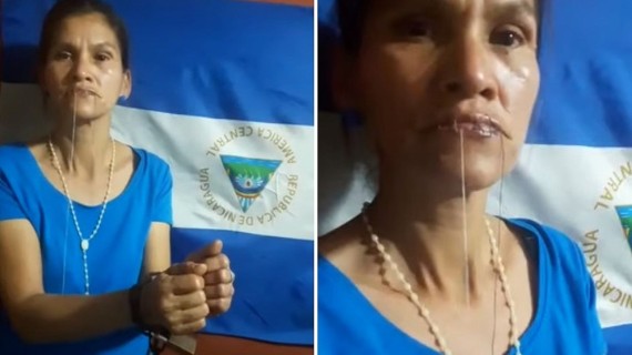 Madre cose sus labios por presos políticos Madre cose sus labios por presos políticos