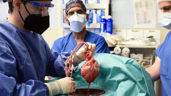 Trasplante de corazón de cerdo a un humano. Foto: Instagram: ABC Diario