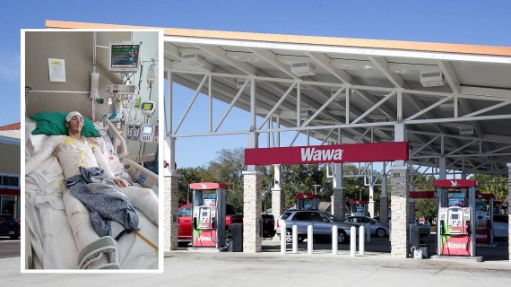 Hombre de Florida es "cocinado vivo" tras ser electrocutado por oficiales en una estación de servicio Hombre de Florida es "cocinado vivo" tras ser electrocutado por oficiales en una estación de servicio