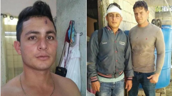 Yunier Gutiérrez con herida por disparo. Yunier Gutiérrez con herida por disparo.