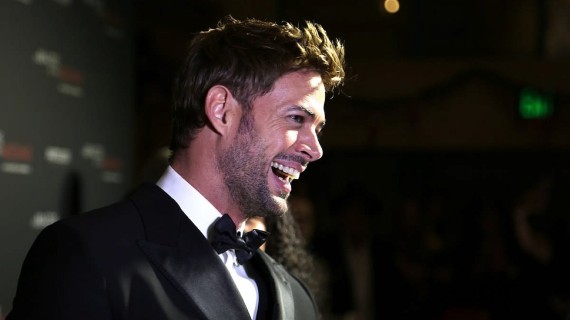 Levy subastó tres besos para una causa benéfica | Instagram Levy subastó tres besos para una causa benéfica | Instagram