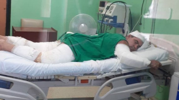 Villalonga Villalonga sufrió quemaduras de tercer grado en la espalda, brazos, cabeza y piernas Matanzas "se olvidó de Yasmani", declara la esposa del chofer herido en incendio de Base de Supertanqueros