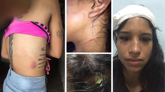 Joven cubana sufrió fuerte agresión en Ciego de Ávila