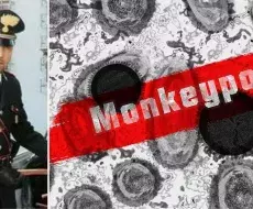 Muere italiano con viruela del mono en Cuba. Fotomontaje: ADN Cuba