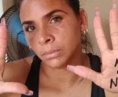 Lizandra Góngora, presa política cubana