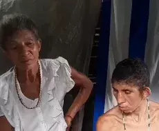 Madre cubana con un hijo discapacitado vive en extrema pobreza