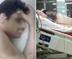 Fallece joven cubano con discapacidad en hospital de Santa Clara