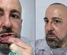 Agresión al médico Lucio Enríquez Nodarce