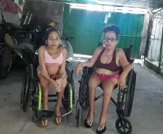 Madre e hija cubanas con rara enfermedad