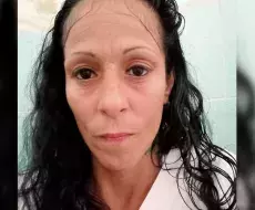 Denuncian falta de atención médica en la cárcel para presa política con VIH Daisy Rodríguez