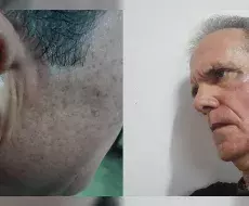 Escritor cubano Jorge Fernández Era, golpeado por un teniente de la policía política en julio de 2025