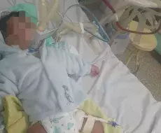 Bebé cubano necesita cirugía urgente