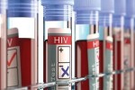 Pacientes con VIH denuncian falta de medicamentos en Cuba